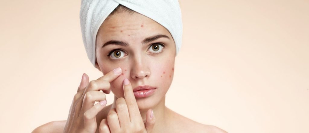 acne treatment clinic